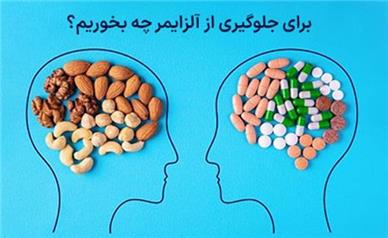 پیشگیری از آلزایمر با پرکاری