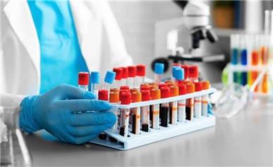 خبرهای خوب از درمان ناباروری مردان تا تولید داروی کم‌خونی